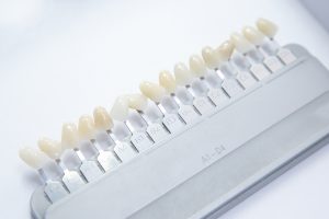 When you get your teeth whitened, the cosmetic dentist will compare the before & after colors to samples to track changes.